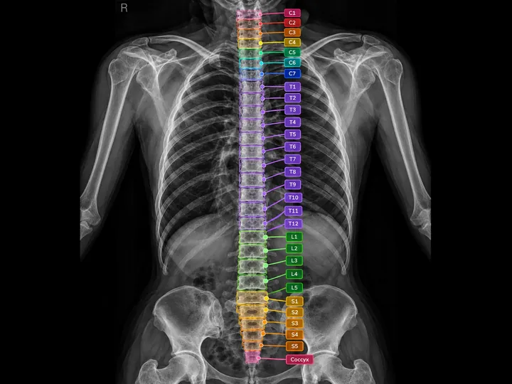 Chest and spine X-ray with each vertebra outlined and labeled from C1 to the coccyx, an example of medical image annotation.